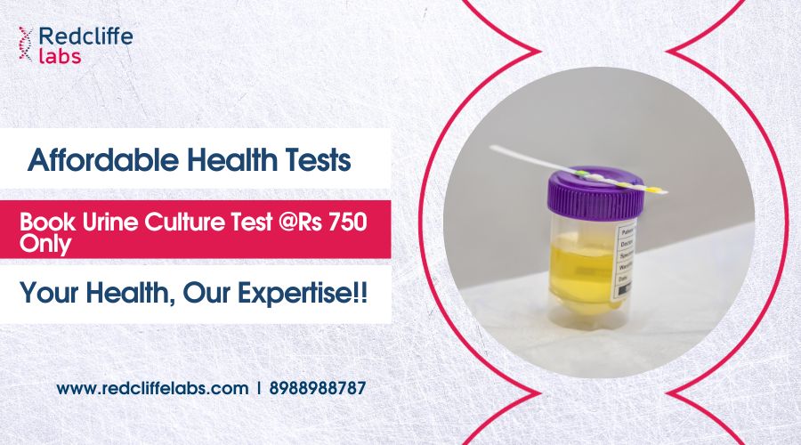 Urine Culture Test price 