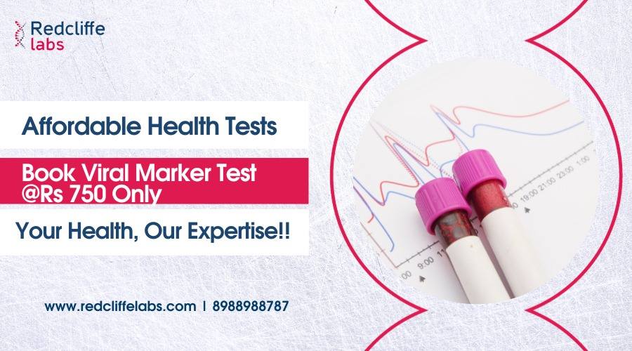 Viral Marker Test Price, Purpose, Procedure 2024