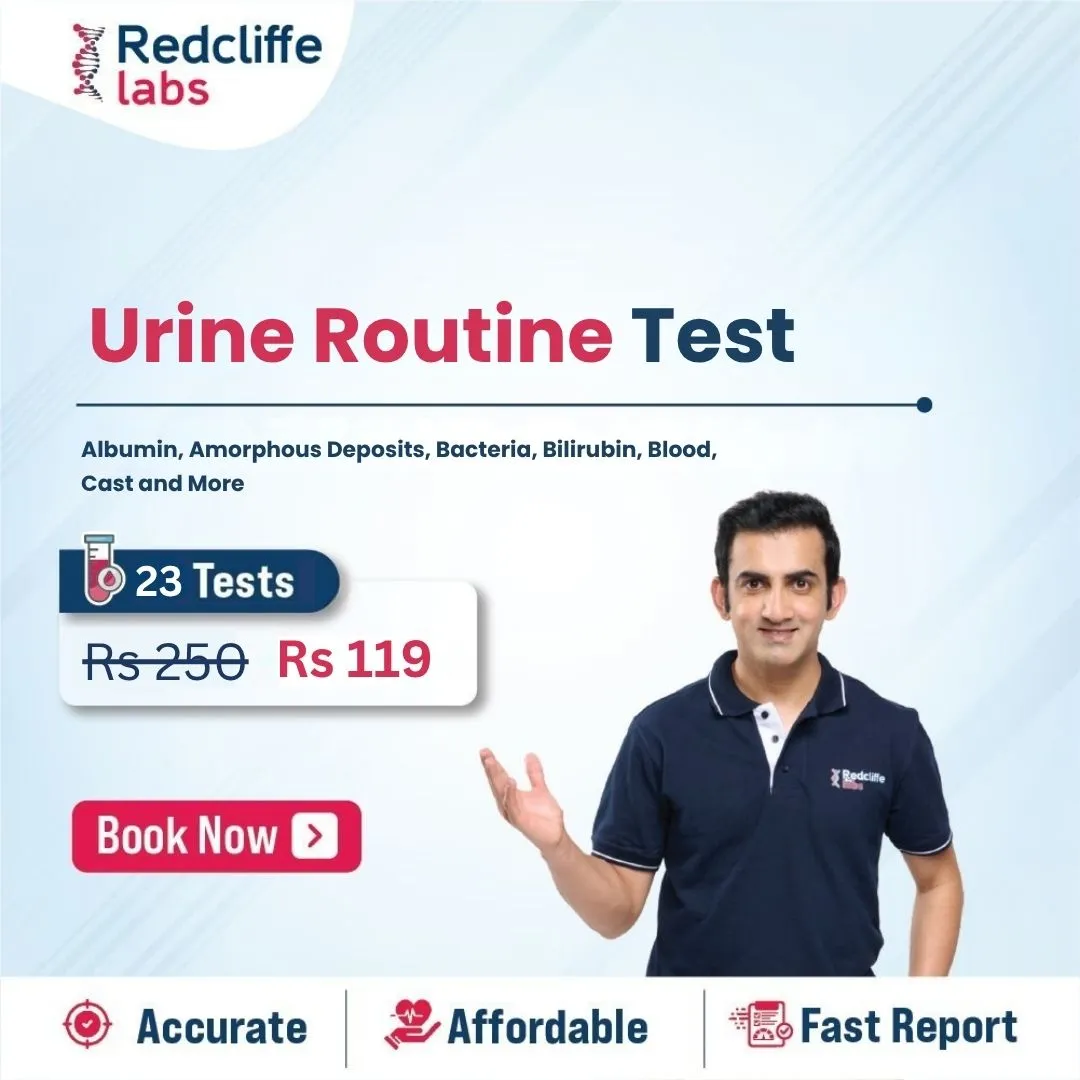 Urine Routine Test price in Noida