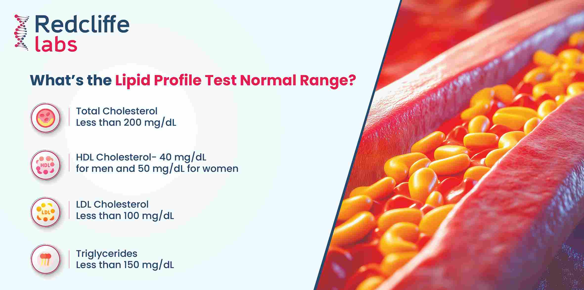 Lipid Profile Test Normal Range