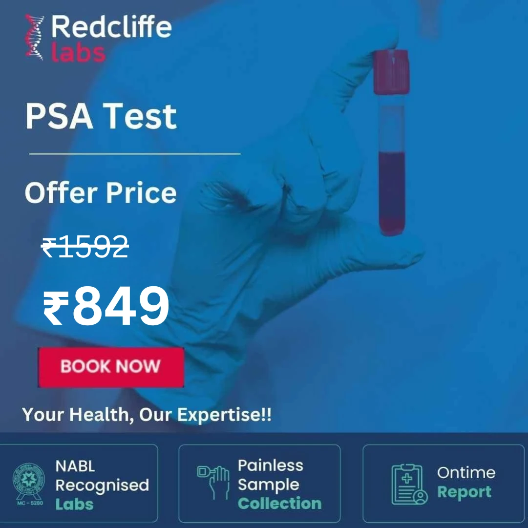 PSA Test - Price, Purpose Procedure, Normal Range, & More